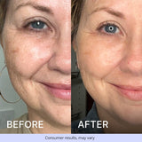 Advanced Repair Eye Cream Add-on