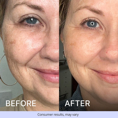 Advanced Repair Eye Cream Add-on