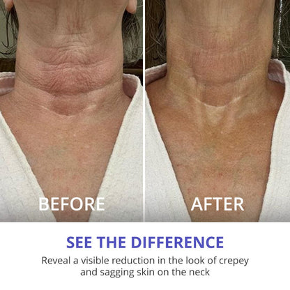 Exclusive Offer: Tighten & Lift Neck Cream (Copy)