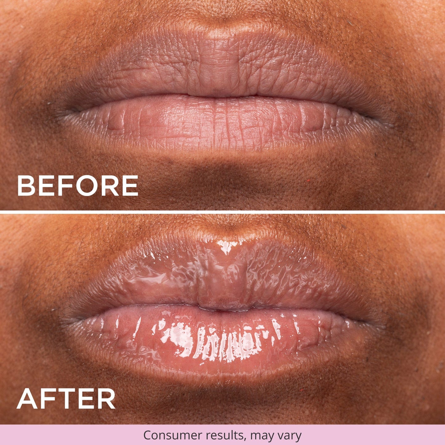 A “Before and After” close-up of darker-toned lips. The top image shows lips with fine lines, and the bottom shows smoother, fuller lips with a glossy finish. Text: “Before” (top) and “After” (bottom). Small text: “Consumer results, may vary.”