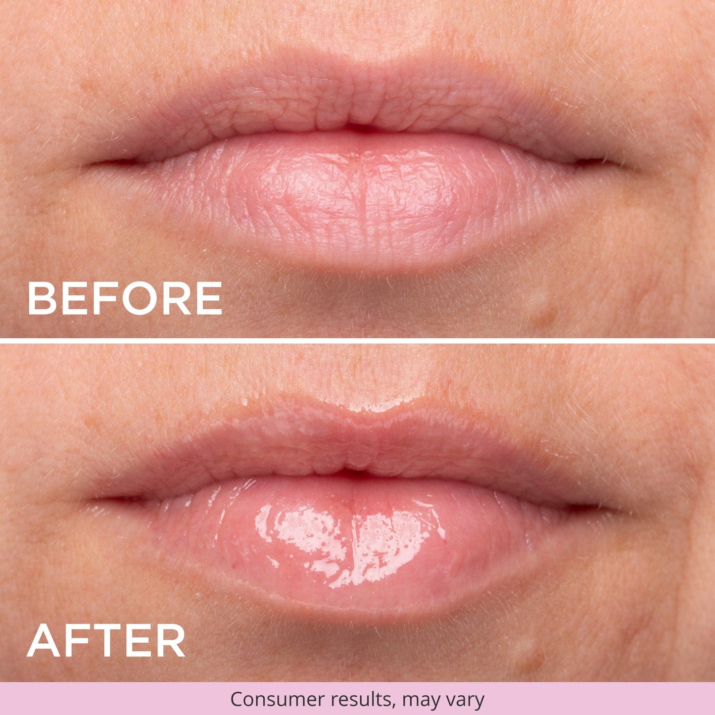 Another close-up “Before and After” of lips. The top shows bare lips with fine lines, and the bottom shows smoother, plumper lips with a glossy finish. Text: “Before” (top) and “After” (bottom). Small text: “Consumer results, may vary.”