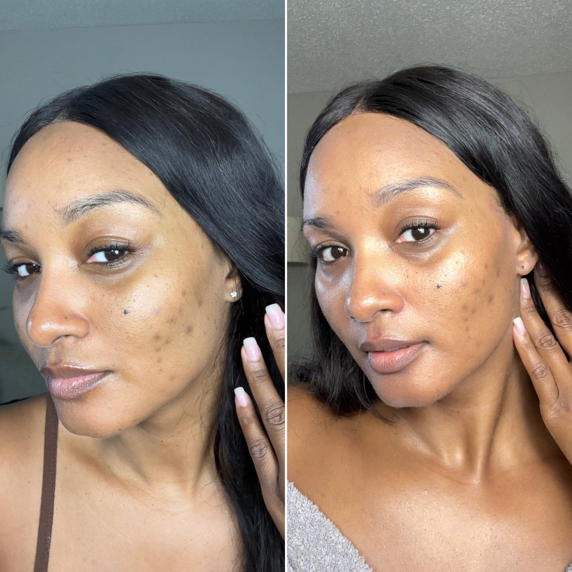  Before and after skincare results of a woman showing clearer complexion, after using SPF.