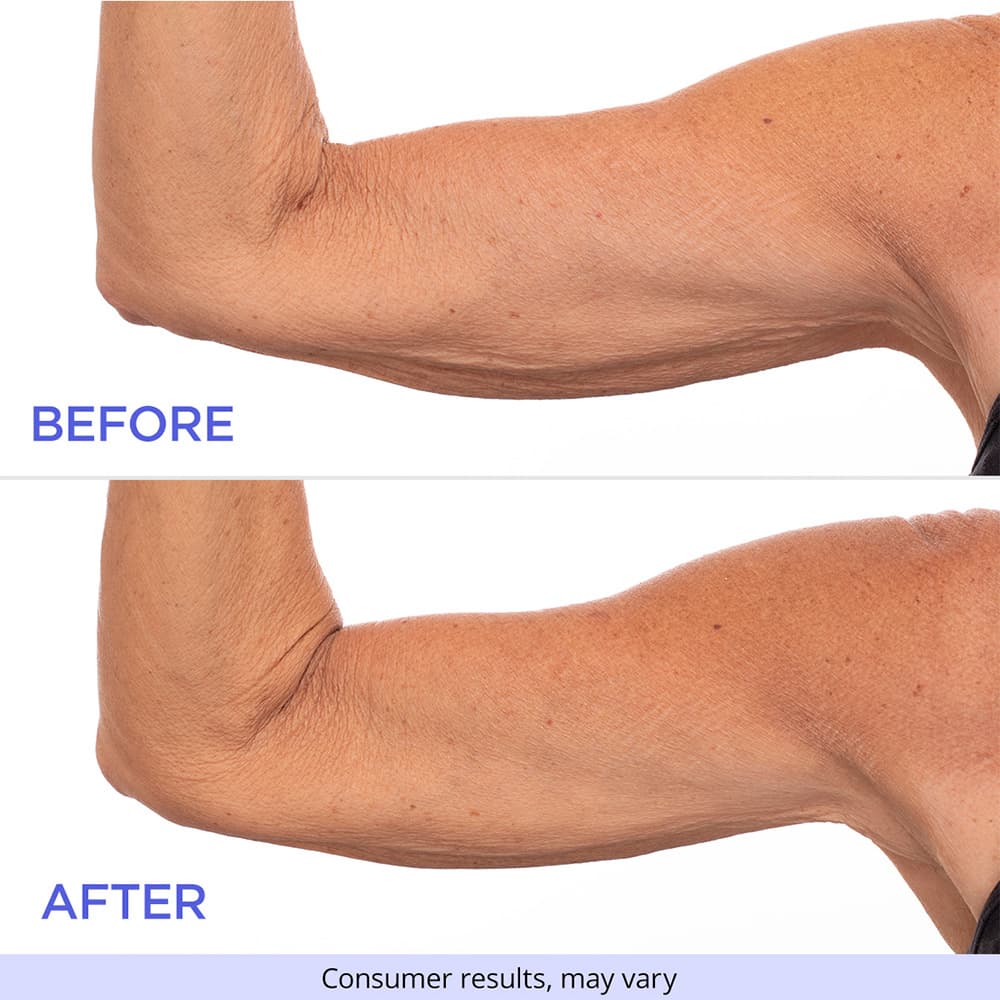 Arm Cream