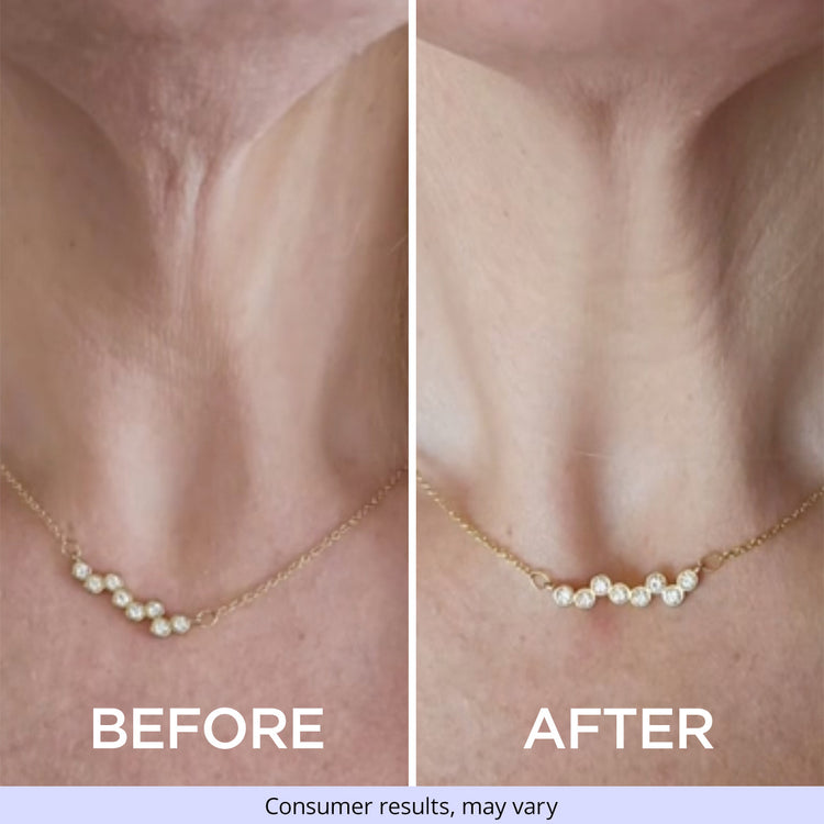 Side-by-side comparison of a woman's neck wearing a pearl necklace, showing "before" and "after" using GoPure Tighten & Lift Neck Cream. The "before" image shows looser skin, while the "after" image shows smoother, firmer skin. Text at the bottom reads, "Consumer results, may vary."