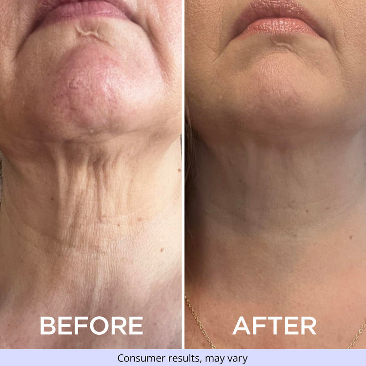 Side-by-side comparison of a woman's neck, showing "before" and "after" using GoPure Tighten & Lift Neck Cream. The "before" image shows loose, wrinkled skin, while the "after" image shows smoother, firmer skin. Text at the bottom reads, "Consumer results, may vary."