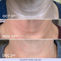 Try Before You Buy: Tighten & Lift Neck Cream