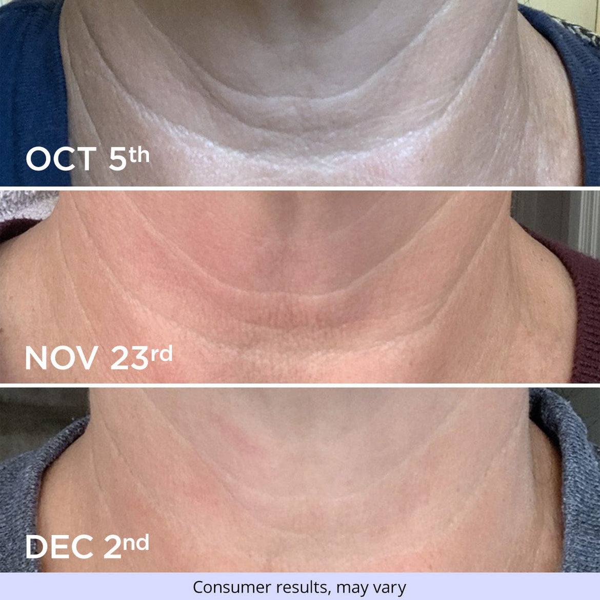 Exclusive Offer Tighten & Lift Neck Cream goPure Beauty Skin Cream