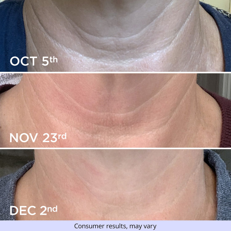 Three images of a woman's neck showing progress over time using GoPure Tighten & Lift Neck Cream. The top image is labeled "Oct 5th" showing initial wrinkles and lines. The middle image is labeled "Nov 23rd" showing reduced wrinkles. The bottom image is labeled "Dec 2nd" showing further improvement with smoother skin. Text at the bottom reads, "Consumer results, may vary."
