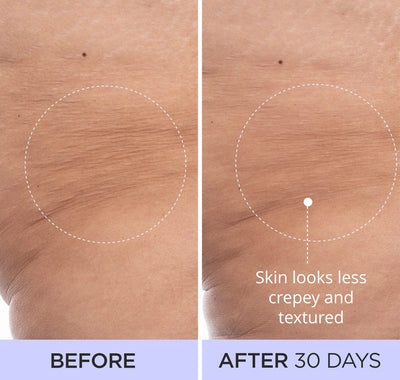 Before and after #4