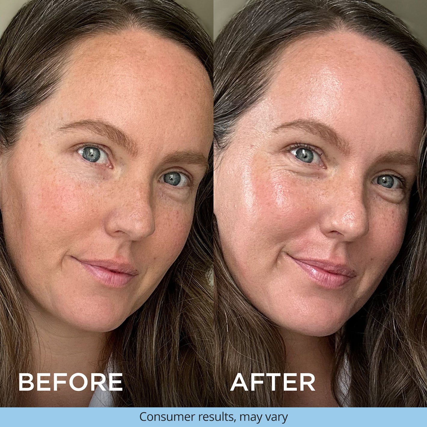 Side-by-side close-up of a woman’s face. The "before" image shows her natural complexion, while the "after" image shows smoother, more radiant skin.