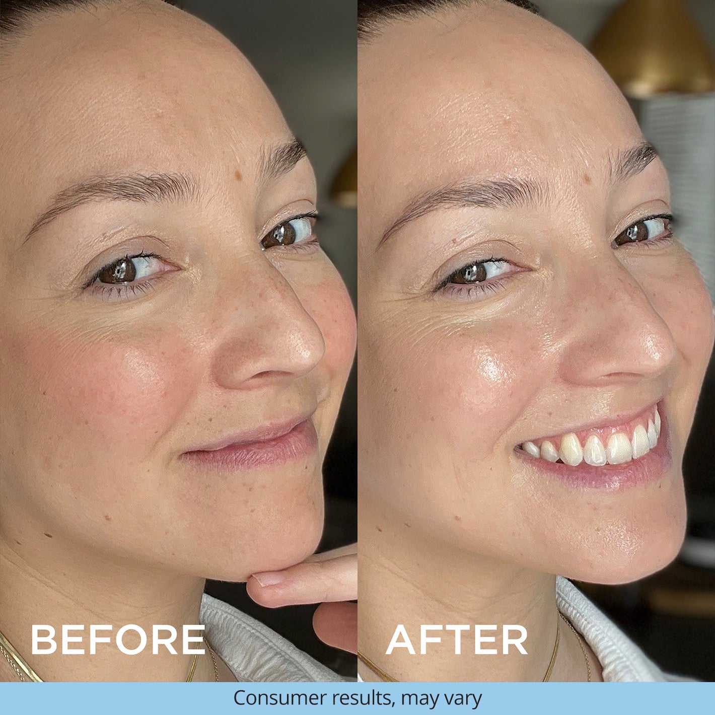 Close-up of a smiling woman’s face. The "before" image shows her skin with a natural texture, and the "after" image appears more even and glowing.